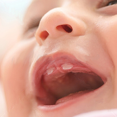 Concern for Baby Oral Hygiene