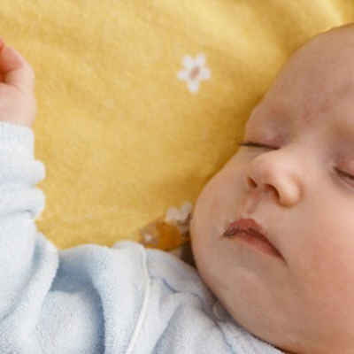兒童阻塞性睡眠窒息症的成因