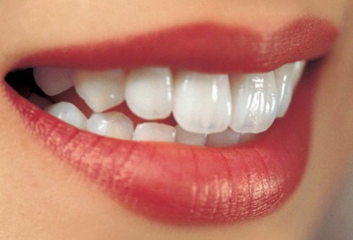 牙齒過度美白 蝕壞牙