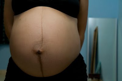 為什麼懷孕的肚皮會有黑黑醜醜的線？