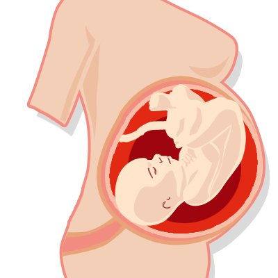 孕期的困擾－便秘與痔瘡