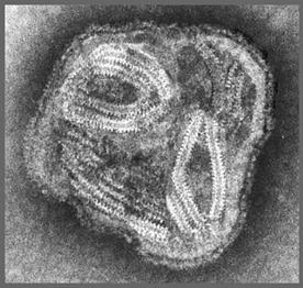同時染細菌入血增兒童死亡率 副黏液病毒比流感更惡