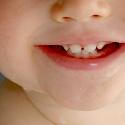 Baby sleeping with baby bottle can lead to tooth decay