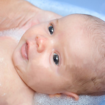 How to Deal with Cradle Cap on my Baby?